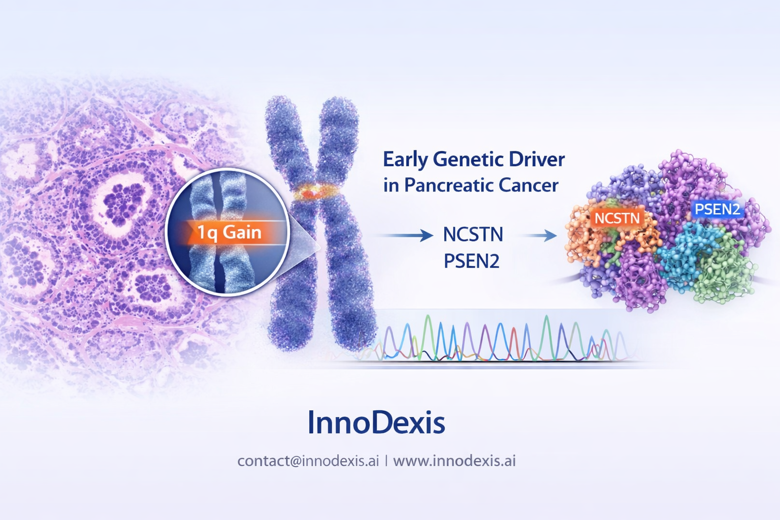 Chromosome 1q Gains Identified as Early Genetic Driver in Pancreatic Cancer Progression