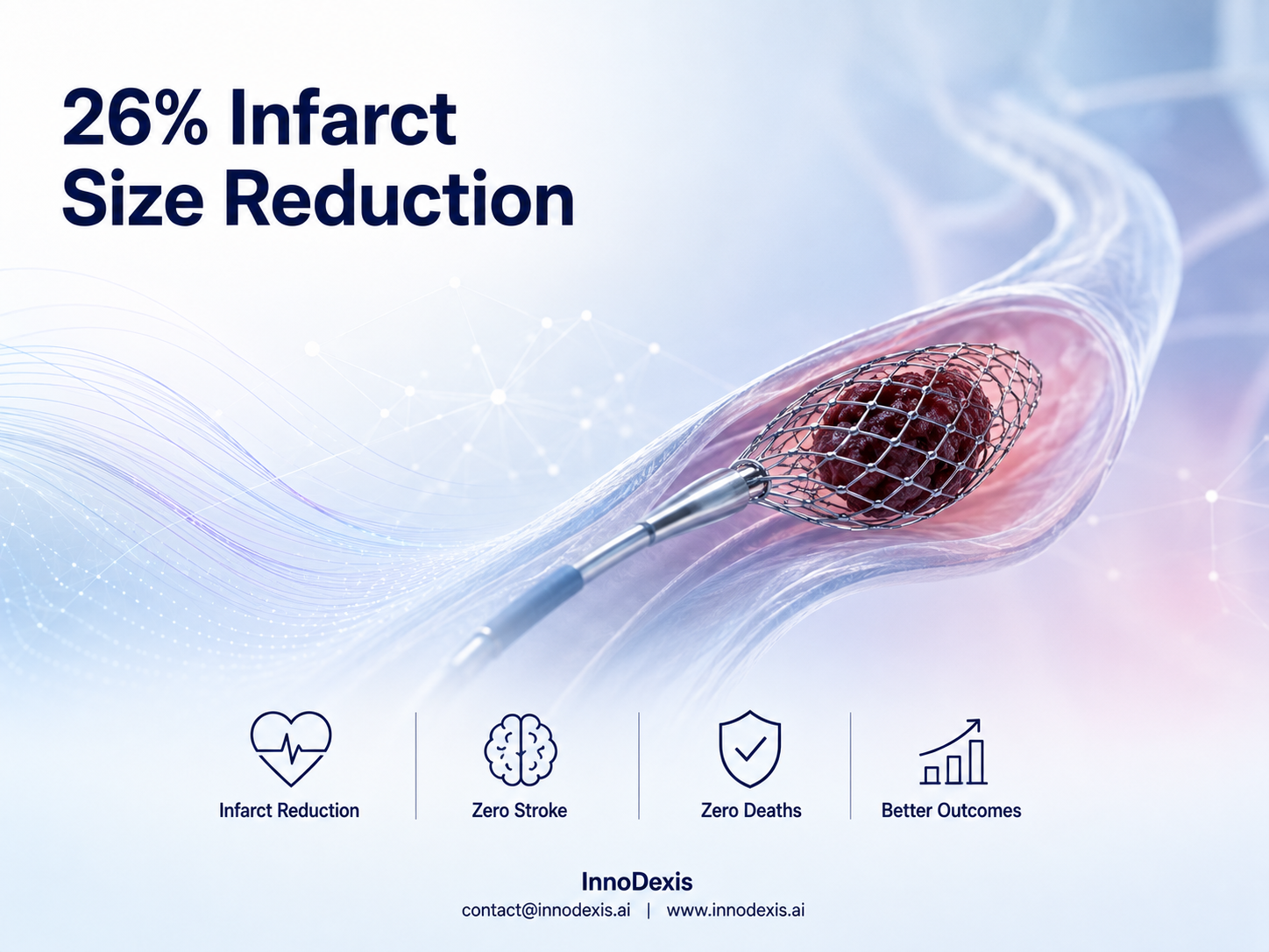 Randomized Trial of Coronary Clot Retrieval Device Delivers 26% Infarct Size Reduction with Zero Strokes and Zero Deaths in STEMI Patients